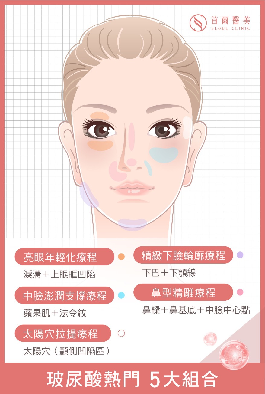 玻尿酸適應部位-臉部適應13部位一次看-首爾醫美診所 玻尿酸適應部位-臉部適應13部位一次看-首爾醫美診所