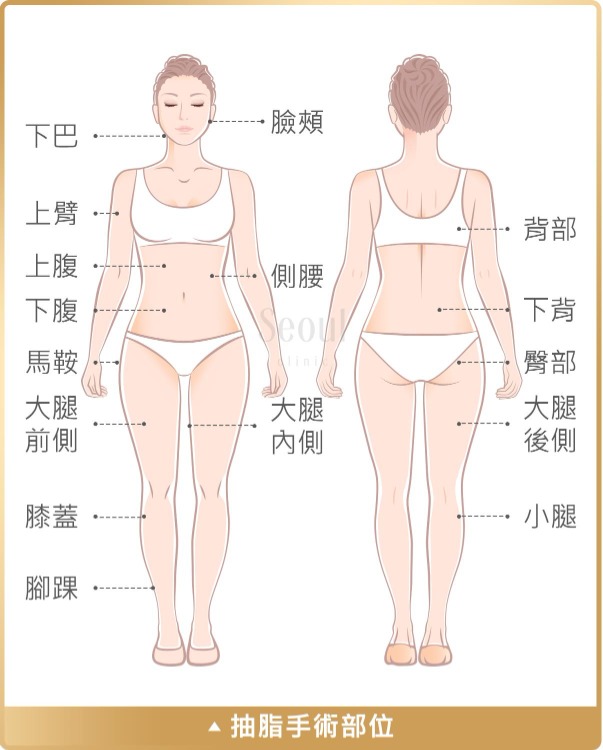 抽脂手術_抽脂部位_首爾醫美