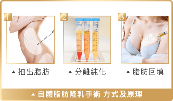 自體脂肪隆乳_手術原理_首爾醫美