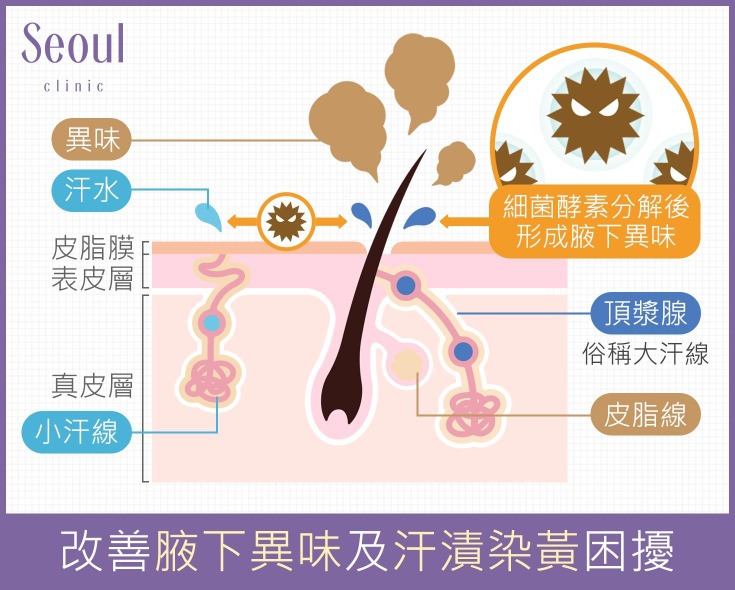 玻尿酸注射_治療原理_首爾醫美