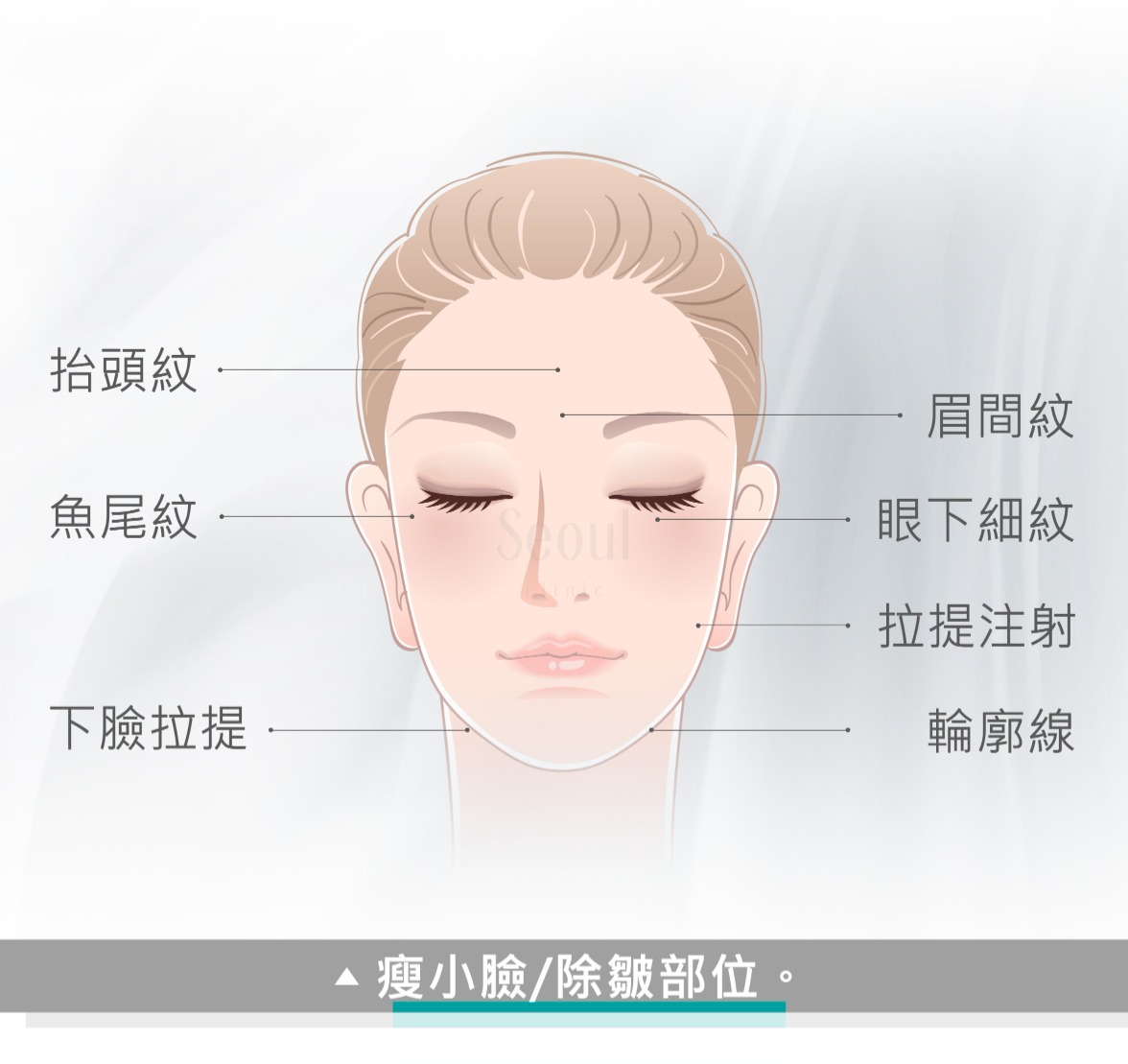 瘦小臉除皺_作用部位_首爾醫美