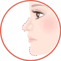 喬雅露_適應對象欲改善輪廓者_首爾醫美