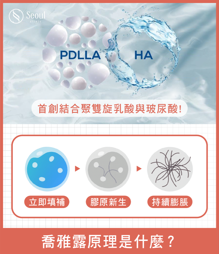 喬雅露-治療原理-首爾醫美