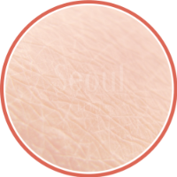 喬雅露_適應對象欲撫平紋路者_首爾醫美