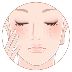 喬雅露_適應對象欲填補凹陷者_首爾醫美