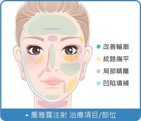 瑞絲朗_治療部位_首爾醫美 瑞絲朗_治療部位_首爾醫美