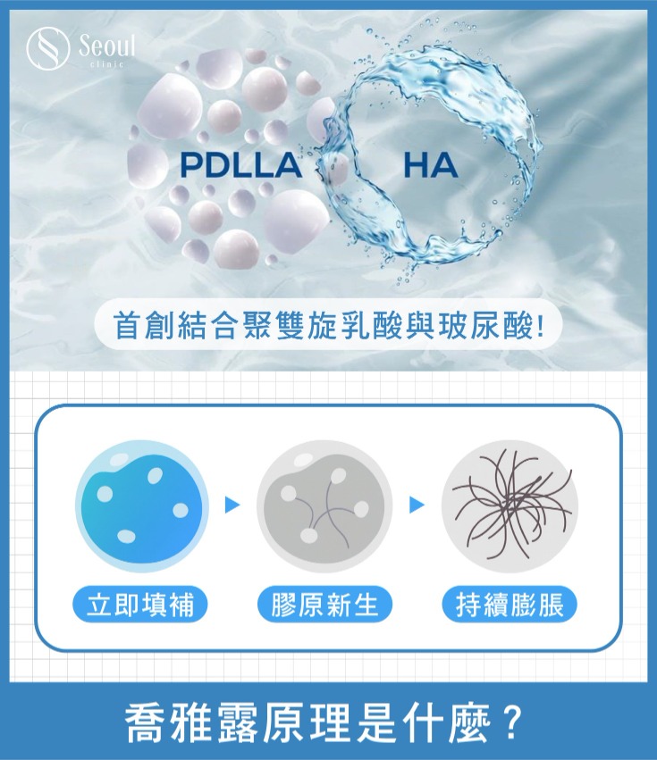 喬雅露_喬雅露 治療原理_首爾醫美 喬雅露_喬雅露 治療原理_首爾醫美