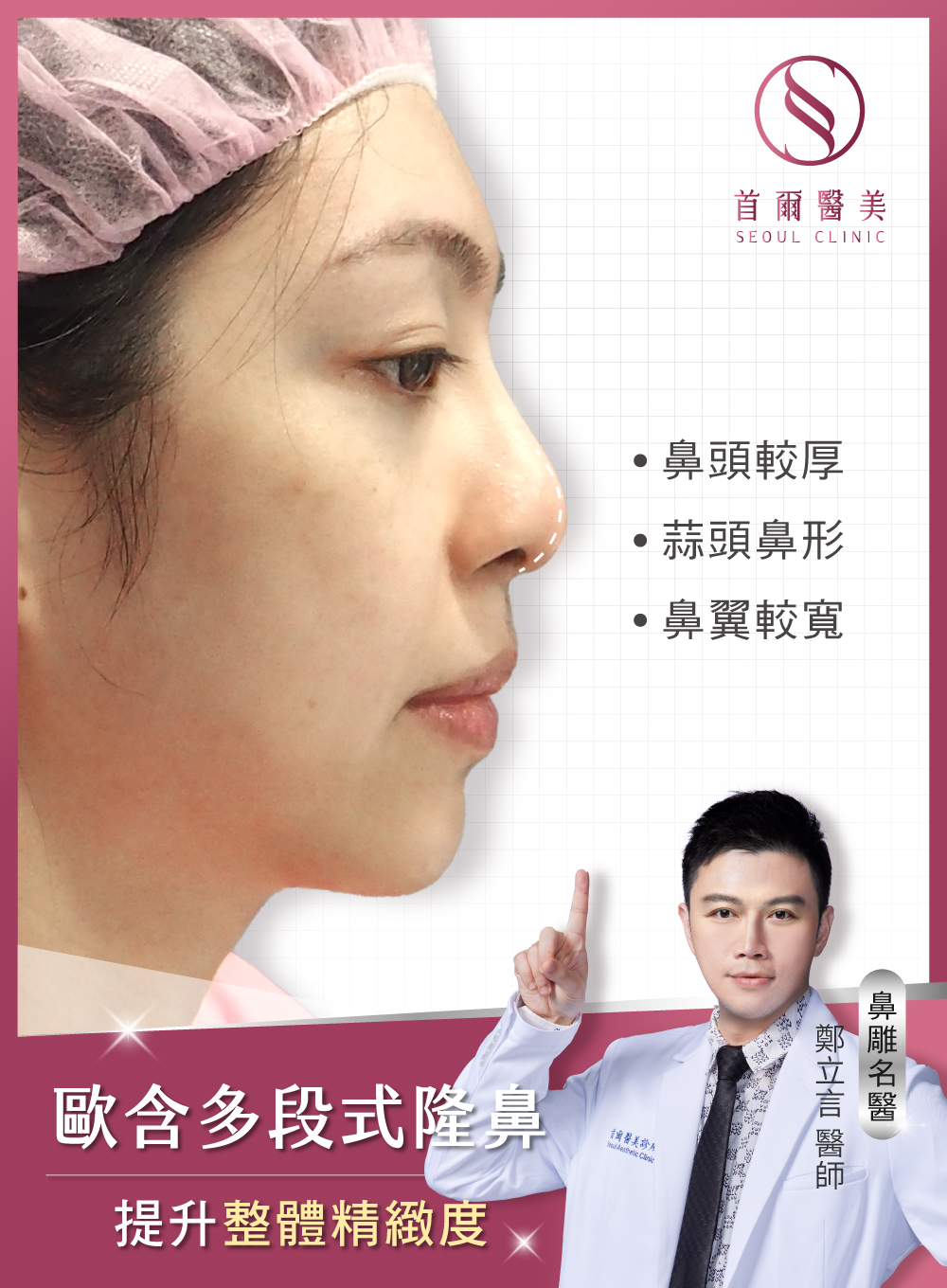 歐韓多段式隆鼻手術-提升鼻型精緻度-首爾醫美