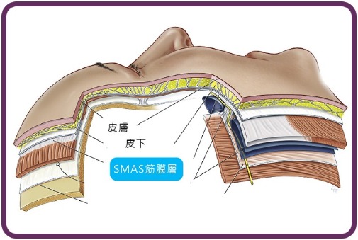 拉皮手術_拉皮原理_首爾醫美