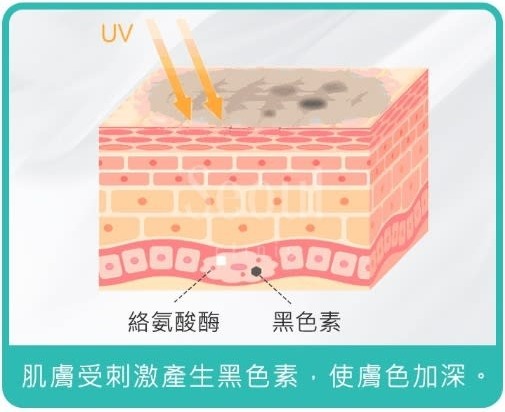 術後保養_黑色素產生_首爾醫美
