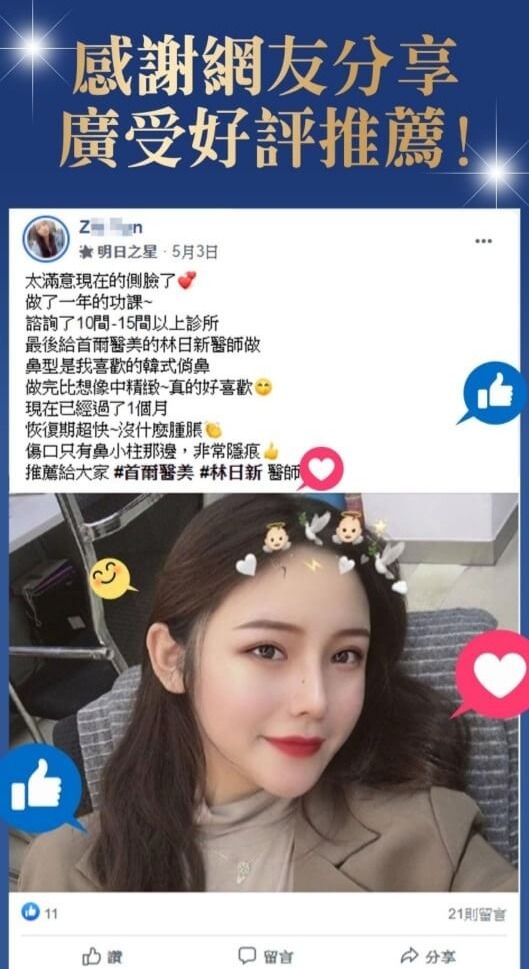 隆鼻手術再進化 歐韓多段式隆鼻挺翹又自然 Seoul首爾醫美整形 隆鼻手術再進化 歐韓多段式隆鼻挺翹又自然 Seoul首爾醫美整形