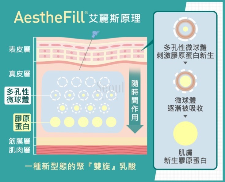 舒顏萃-AestheFill®艾麗斯原理-首爾醫美