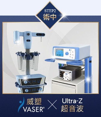 三合一抽脂手術-術中威塑、UltraZ新式儀器二選一-首爾醫美