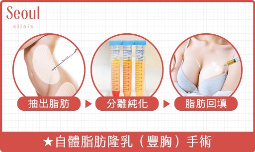 豐胸_自體脂肪隆乳（豐胸）手術_首爾醫美