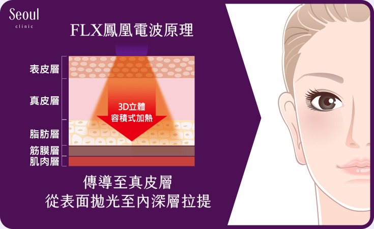 鳳凰電波拉皮-FLX鳳凰電波原理-首爾醫美