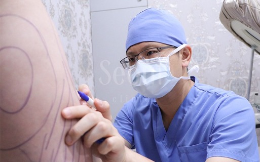 台中抽脂推薦-首爾醫美三合一抽脂手術-手術過程