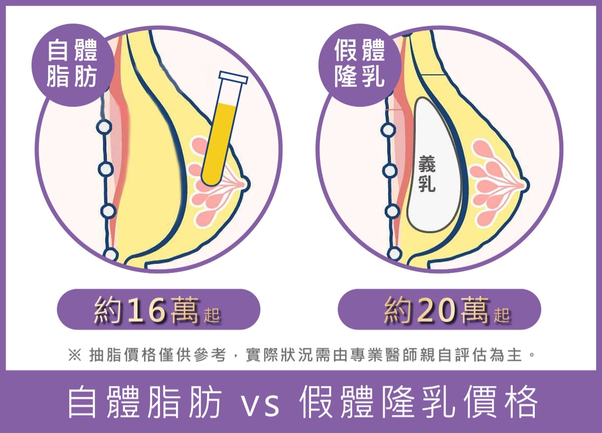 自體脂肪隆乳_隆乳價格費用_首爾醫美