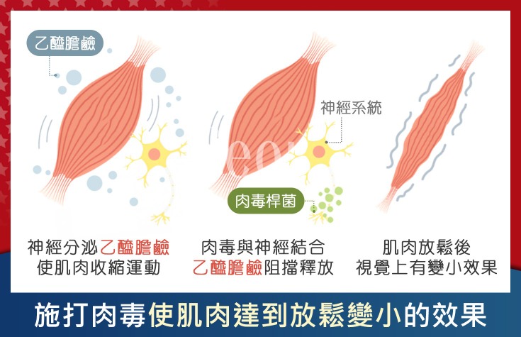 玩美電波Oligo-一個午休找回緊緻肌膚-首爾醫美