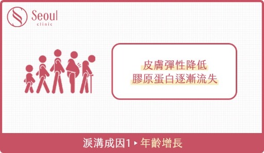 淚溝-淚溝成因1：年齡增長-首爾醫美