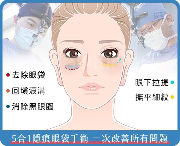 如何有效改善眼袋問題？皮膚科醫生十年經驗分享：完整教學與產品推薦