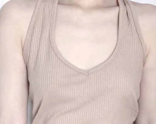 隆乳_隆乳手術Before_首爾醫美