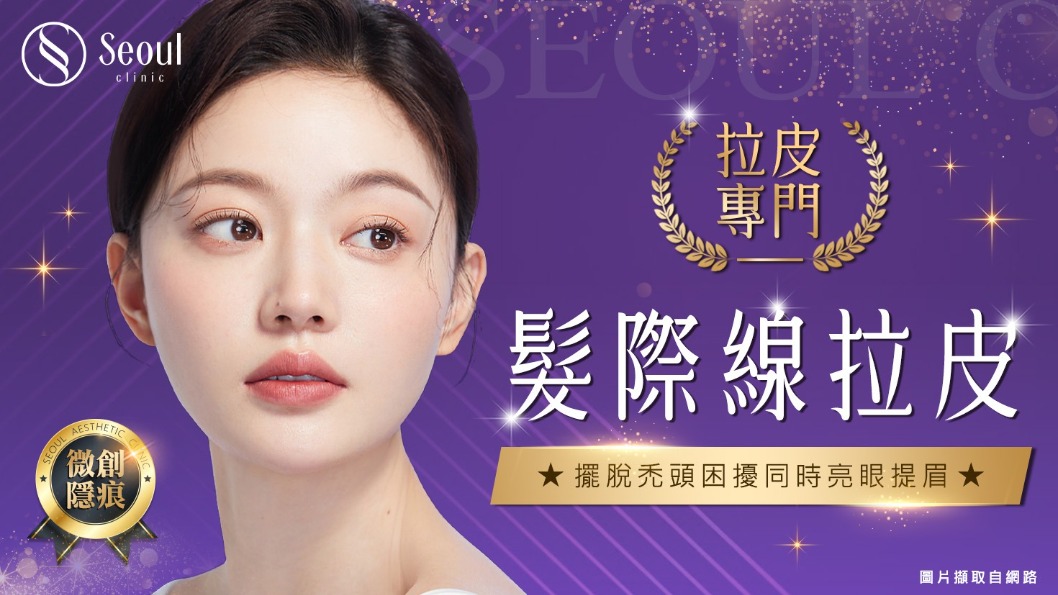 髮際線拉皮-「新式髮際線前移拉皮」找回你的幼態臉！-首爾醫美診所