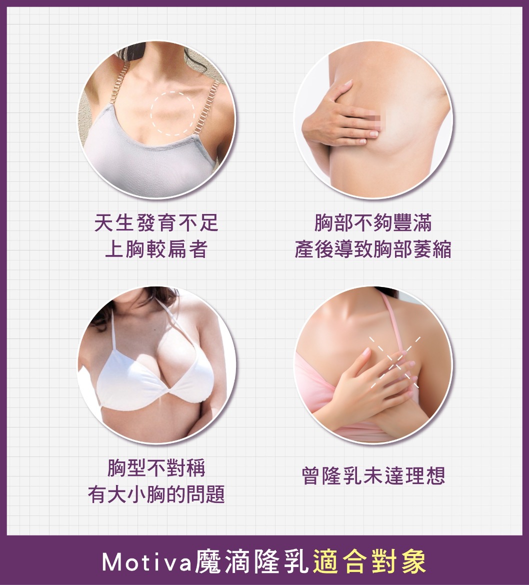 魔滴隆乳-Motiva魔滴隆乳適合對象-首爾醫美