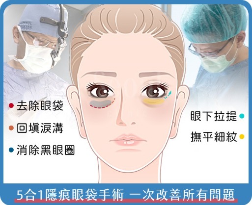 眼袋_五合一隱痕眼袋手術_首爾醫美診所