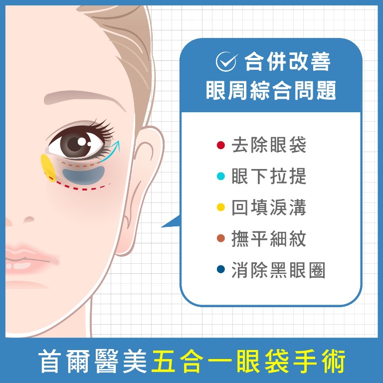 眼袋消除-眼袋專門診所-首爾醫美五合一眼袋手術-首爾醫美診所
