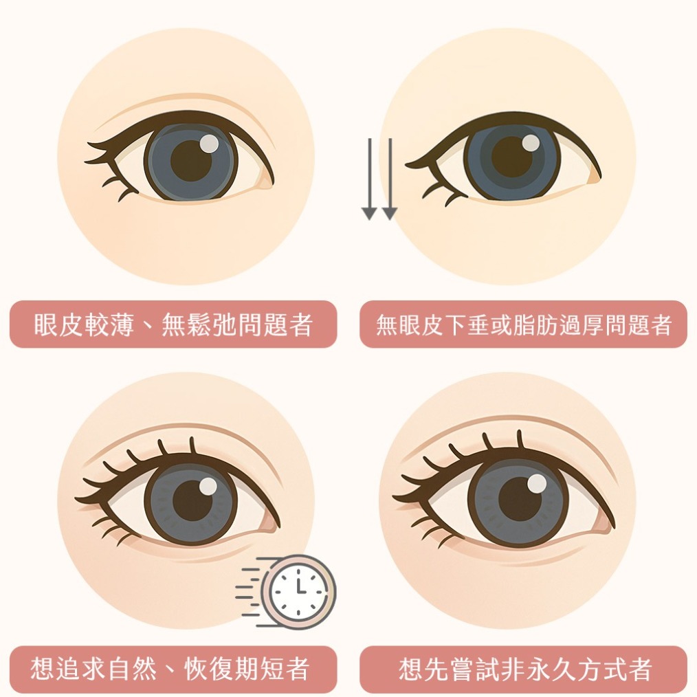 縫雙眼皮-縫雙眼皮適應對象有哪些人-首爾醫美