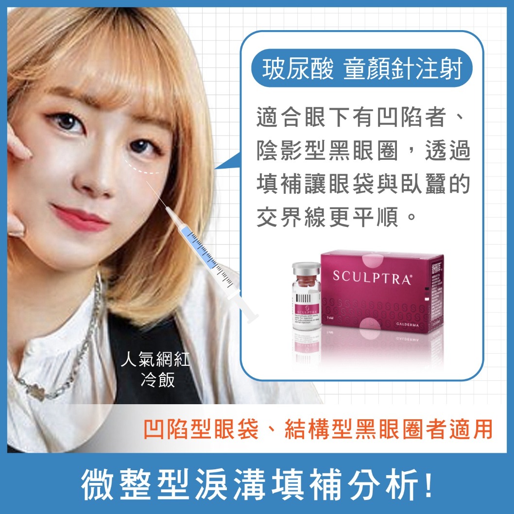 眼袋消除-淚溝型眼袋-玻尿酸注射-首爾醫美診所