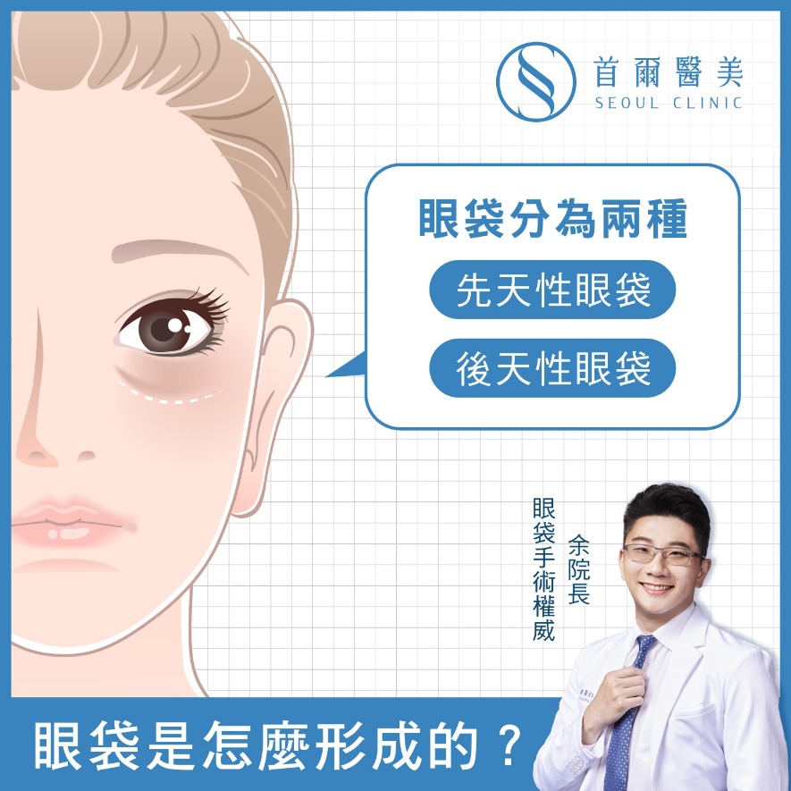 眼袋消除-兩種類型眼袋先天性、後天性你是哪一種-首爾醫美診所