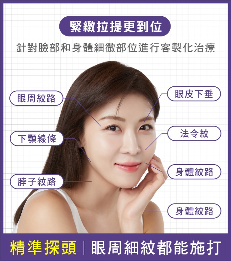 Coolfase電波-4.精準探頭：眼周細紋都能打，緊緻更到位-首爾醫美