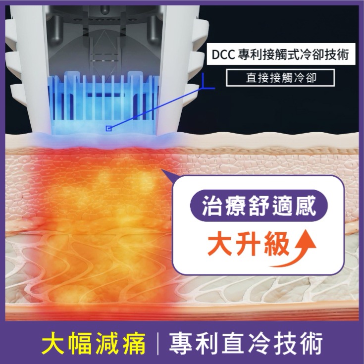 Coolfase電波-1.大幅減痛：專利直冷技術，治療舒適感大升級-首爾醫美