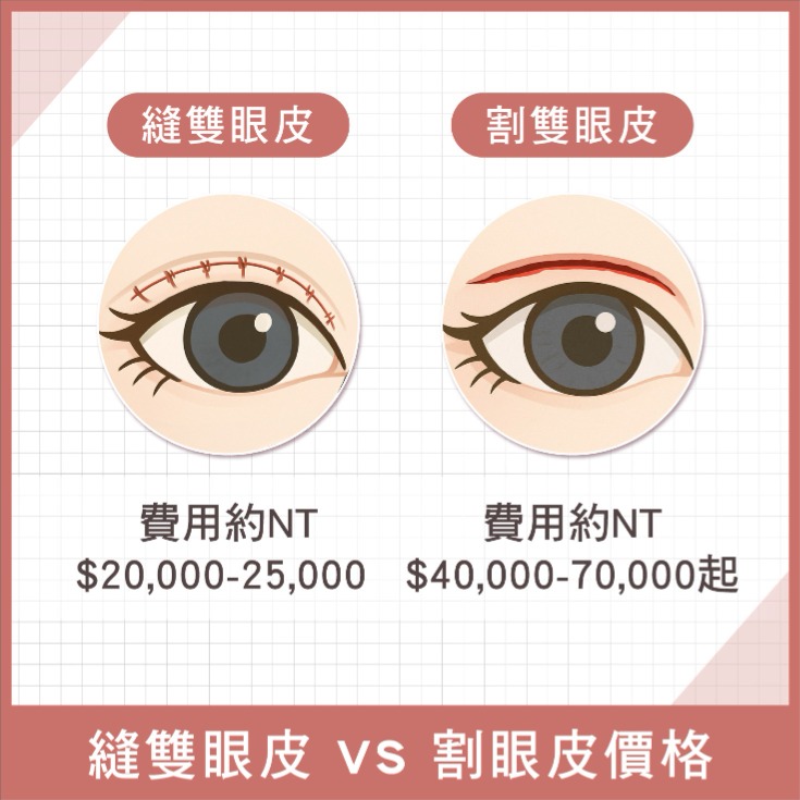 縫雙眼皮-縫雙眼皮價格費用多少？-首爾醫美