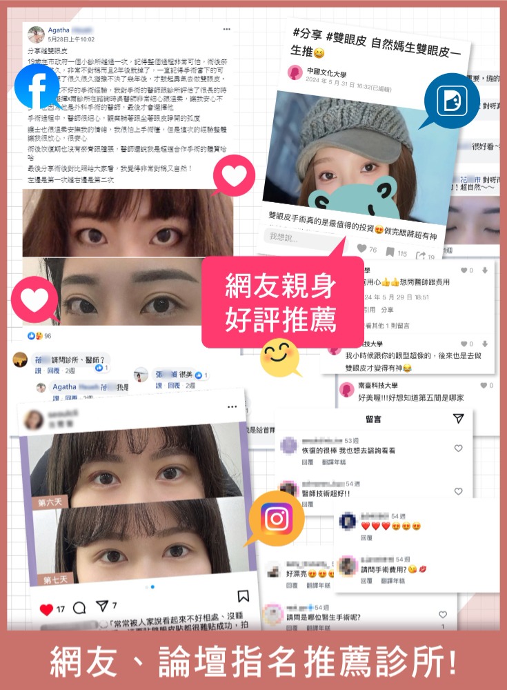 縫雙眼皮-縫雙眼皮時選擇診所時要注意什麼？2. 實際案例與診所口碑-首爾醫美