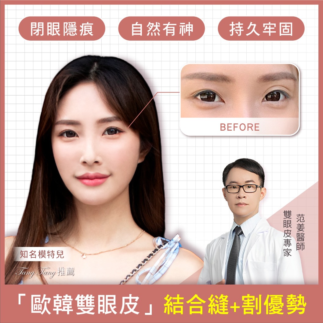 縫雙眼皮-首爾醫美「歐韓雙眼皮」結合“縫+割”優勢-首爾醫美