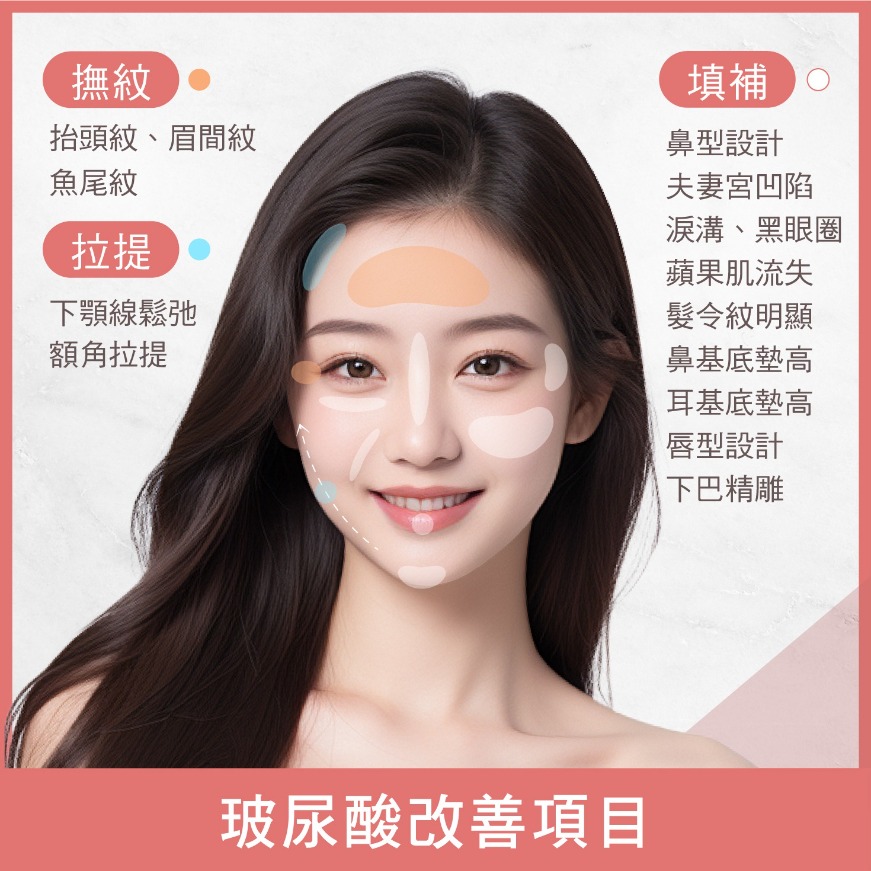 首爾醫美玻尿酸_網紅實證