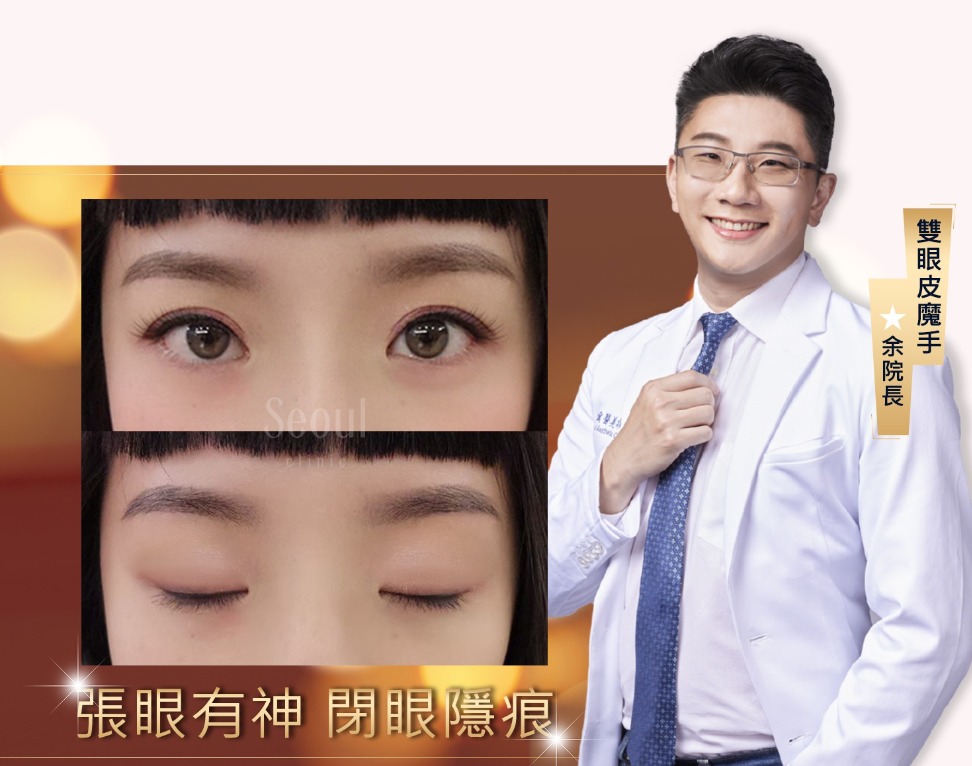 雙眼皮手術_閉眼無痕_首爾醫美