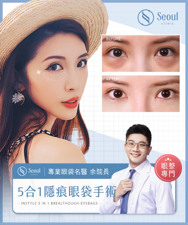 首爾醫美眼袋手術_網紅實證