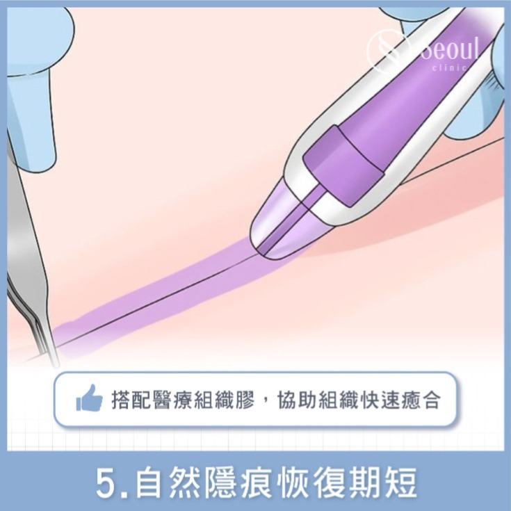 20251003_seo熱門文_眼袋專門診所！5合1隱痕眼袋手術特色、費用，fb、dcard眾多好評推薦！_2_工作區域-1-複本-16