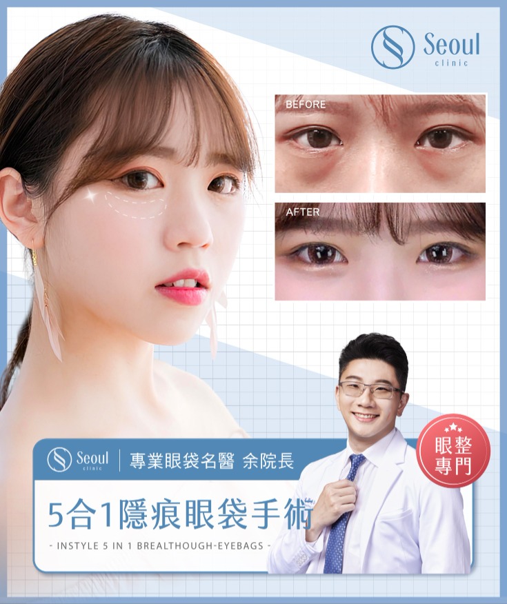 首爾醫美眼袋手術_網紅實證