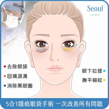 眼袋_五合一隱痕眼袋手術_首爾醫美診所