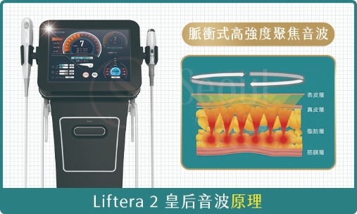 皇后音波-治療原理-首爾醫美