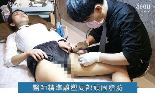 消脂針_心得分享_首爾醫美