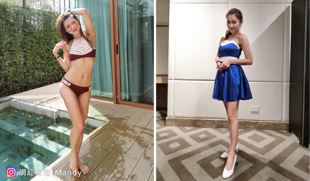 消脂針_術前術後_首爾醫美