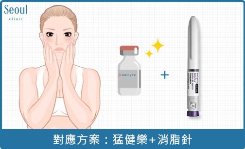 消脂針-局部脂肪堆積，對應方案：善纖達+消脂針-首爾醫美