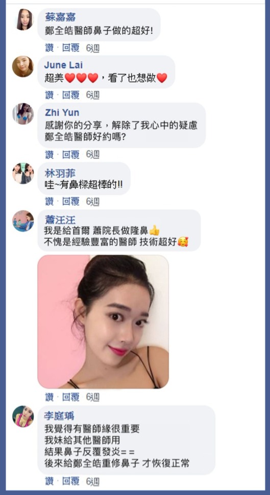 首爾醫美隆鼻手術_林日新推薦