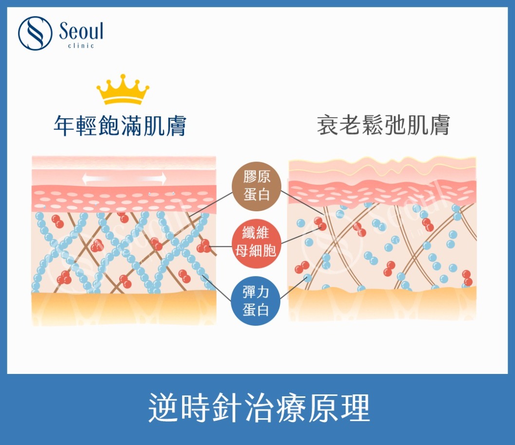 逆時針-逆時針治療原理-首爾醫美 逆時針-逆時針治療原理-首爾醫美