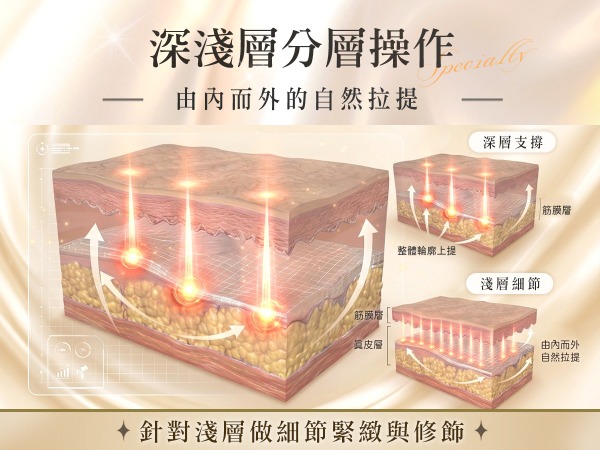 首爾醫美隆鼻手術_隆鼻示意圖 埋線隆鼻_五大優勢3-埋線隆鼻技術_首爾醫美